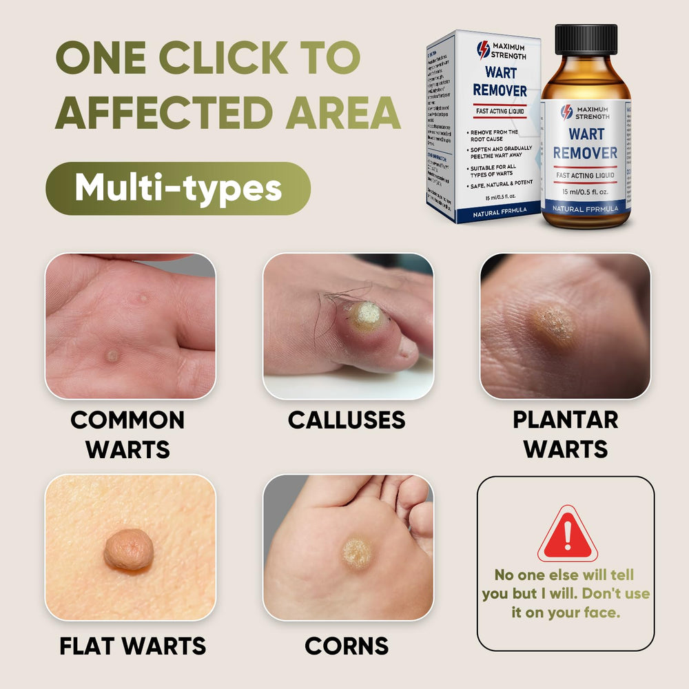 STAY STOKED Wart Remover foot closeup indicating targeted plantar wart care.