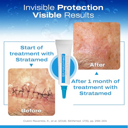 Stratamed dry film can be covered with sunscreen for sun exposure.