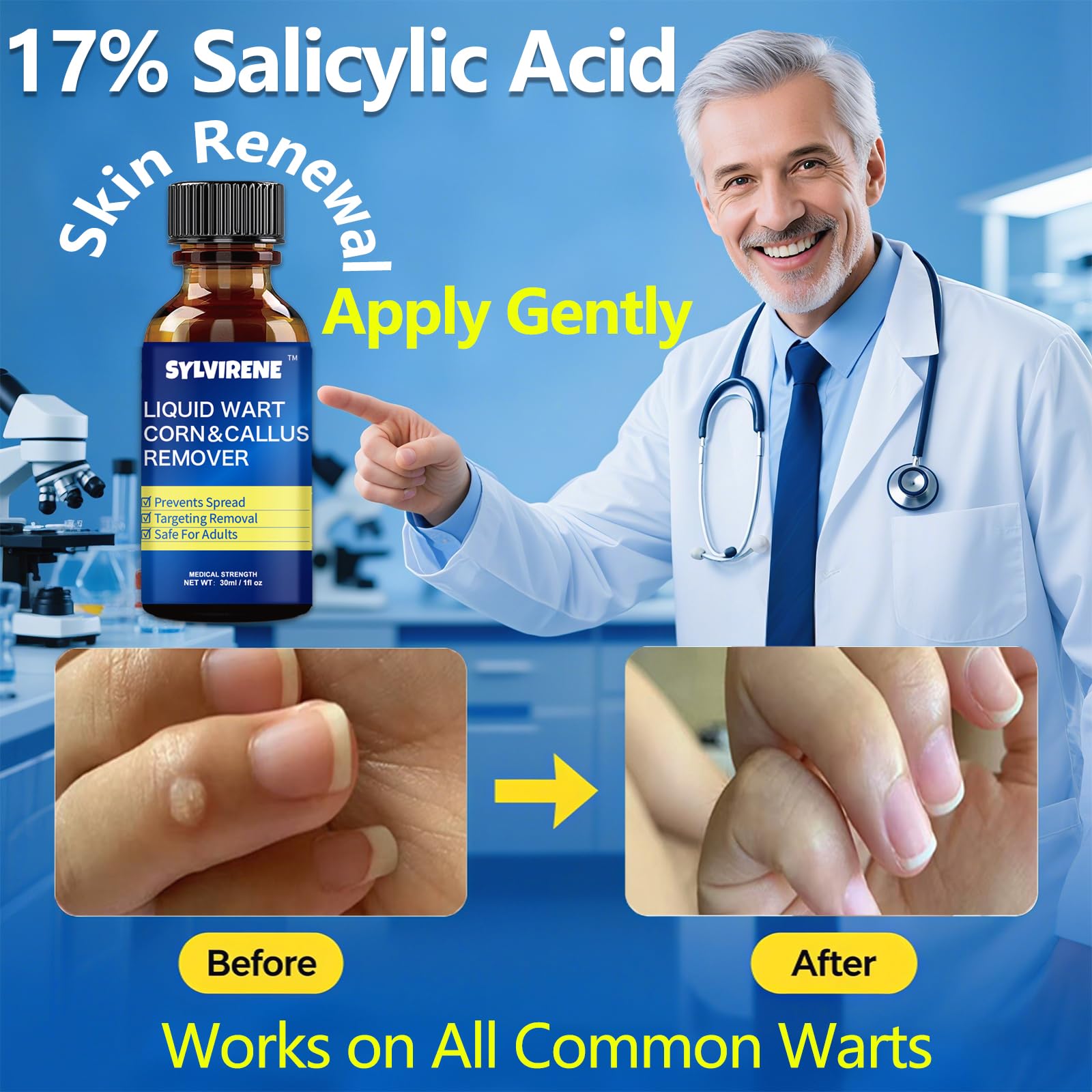 Sylvirene Wart Remover Liquid flat wart treatment for smooth skin