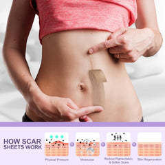 Tamuto scar tape with protective barrier shields UV exposure.