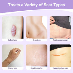 Tamuto silicone scar tape on skin shows soft-breathable wear.