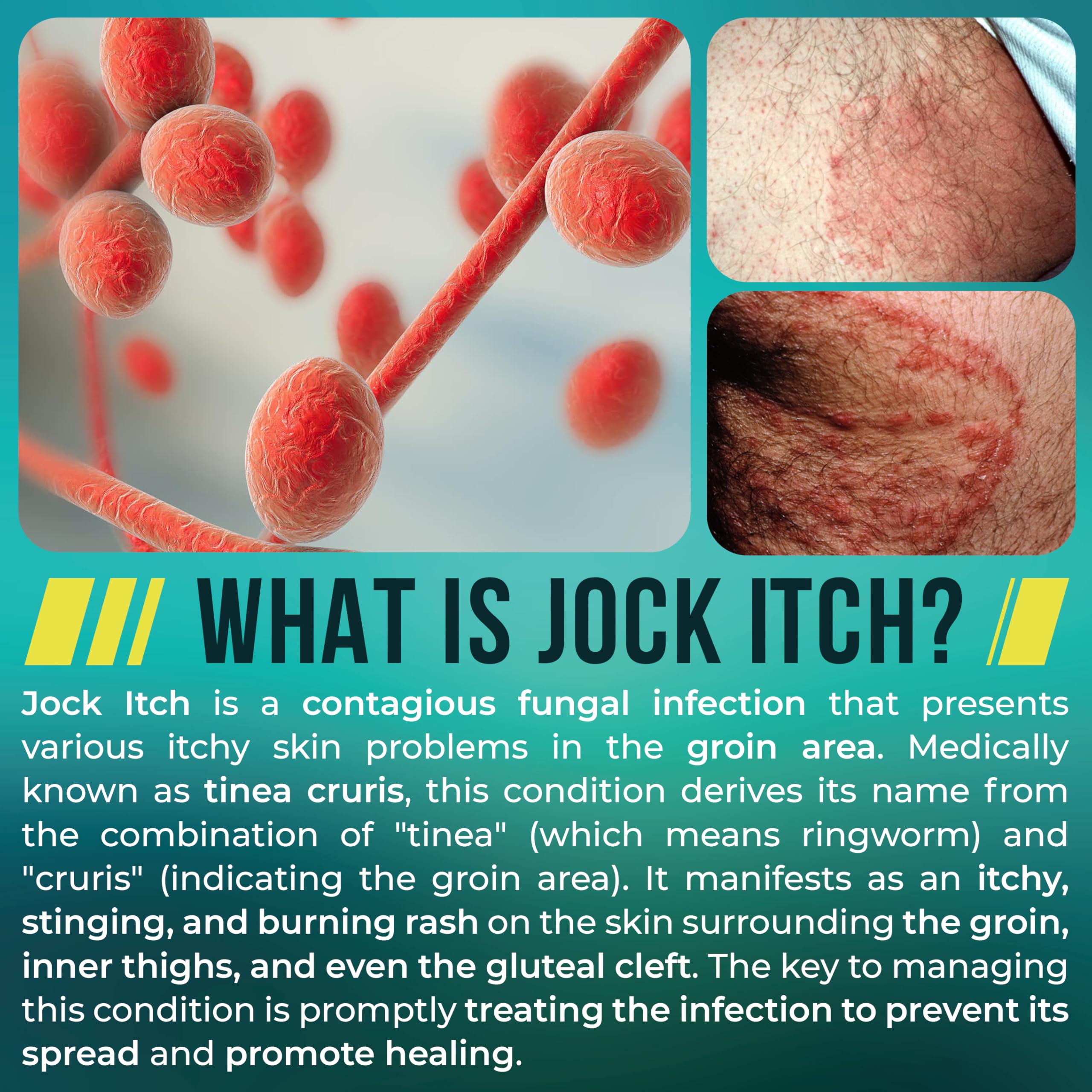 Terramed Just Think Comfort Jock Itch Cream moisturizes to keep skin nourished