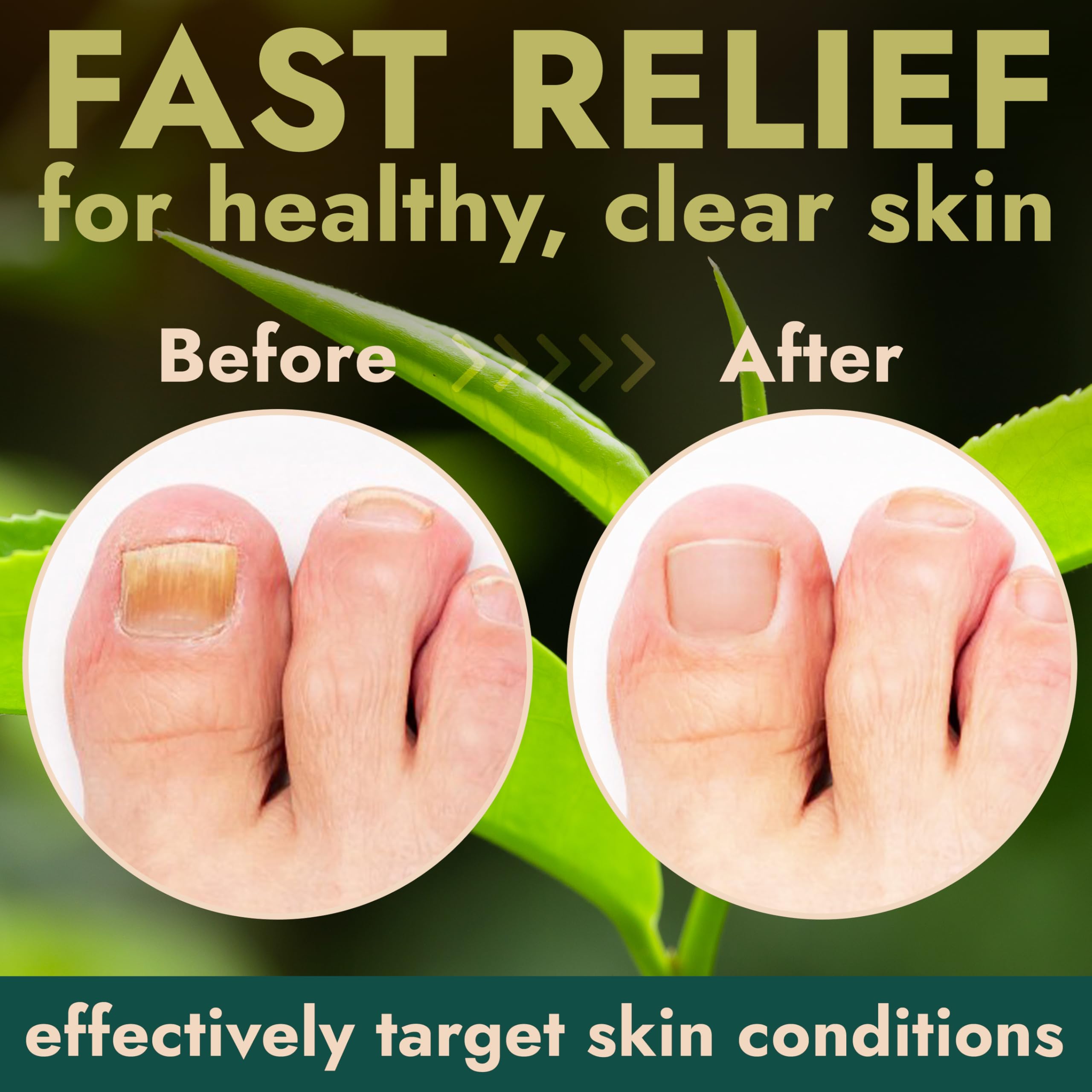 Terramed Just Think Comfort nail health before and after use example.