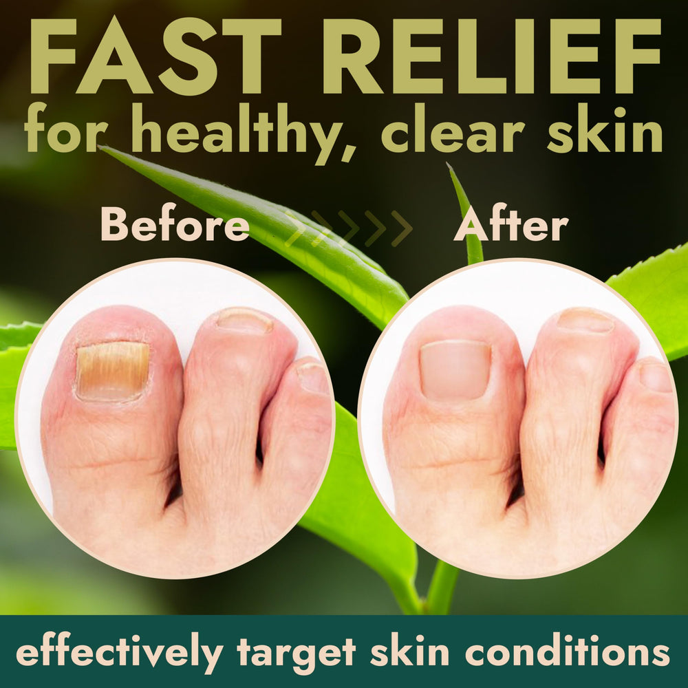 Terramed Just Think Comfort nail health before and after use example.