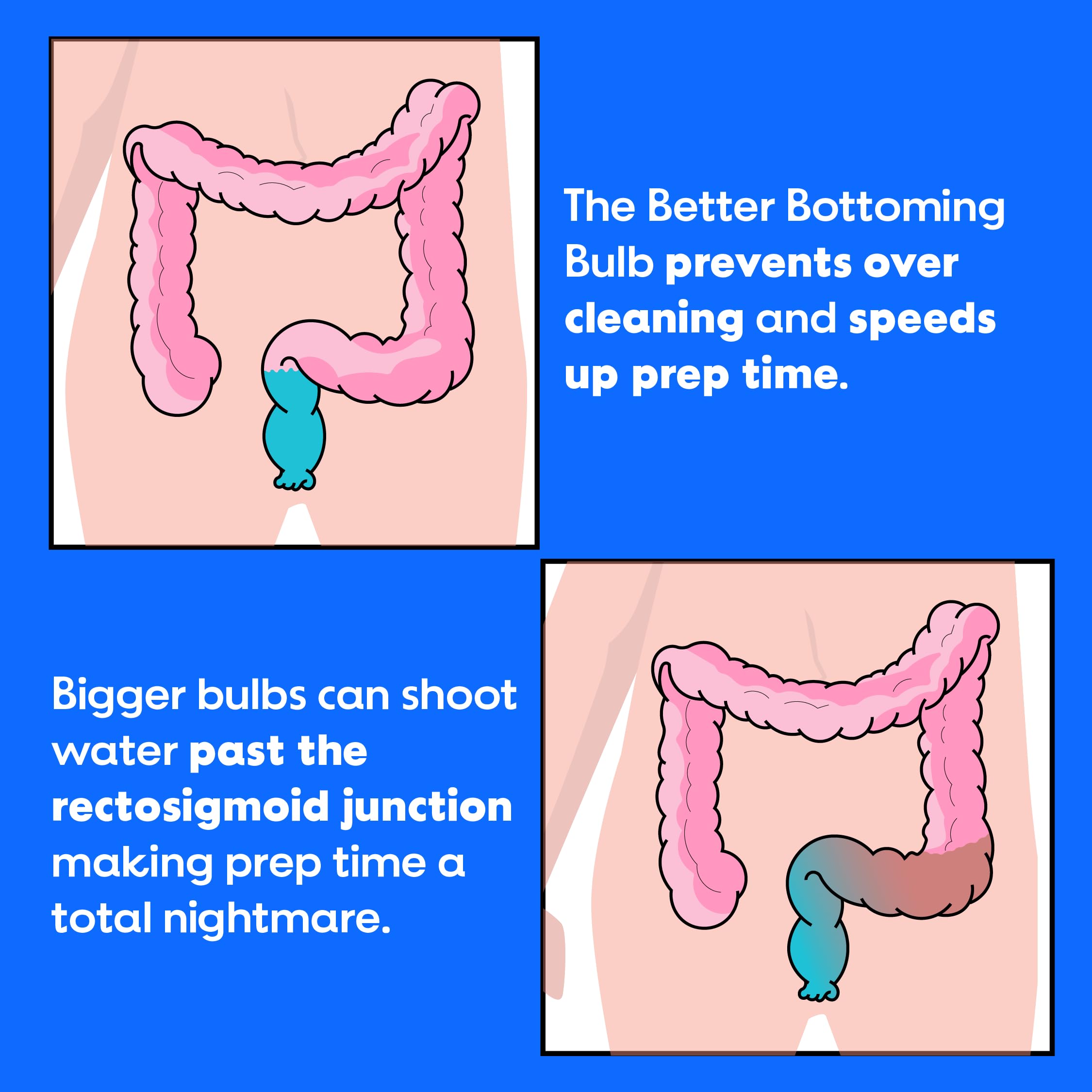 The Bottom's Digest easy-clean 6-cm white tip for precise cleaning during routines.