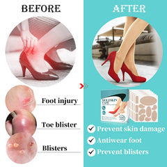 Tiuedu moleskin adhesive pad on shoe side provides targeted friction relief