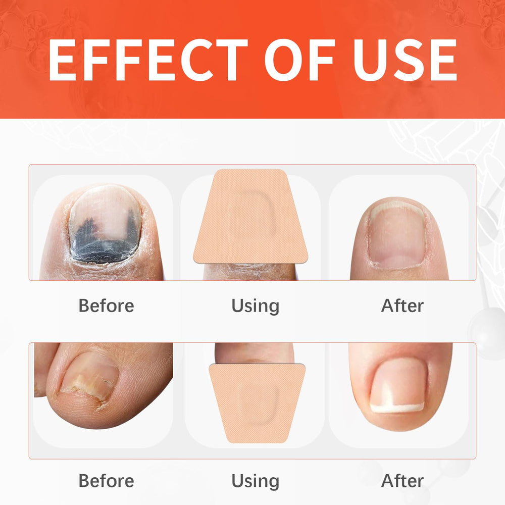 TMPETDENTAL patch kit for travel and everyday nails care