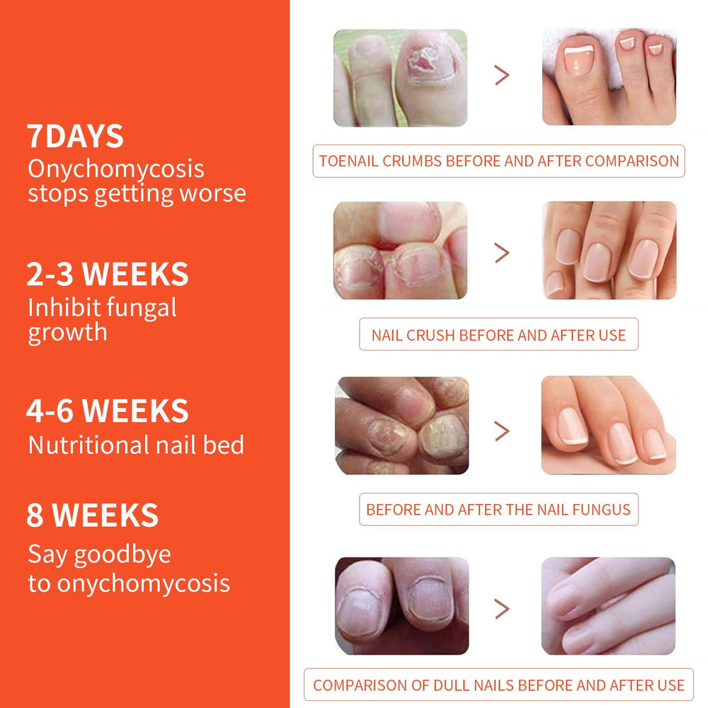 TMPETDENTAL gift-worthy packaging for loved ones facing toenail concerns