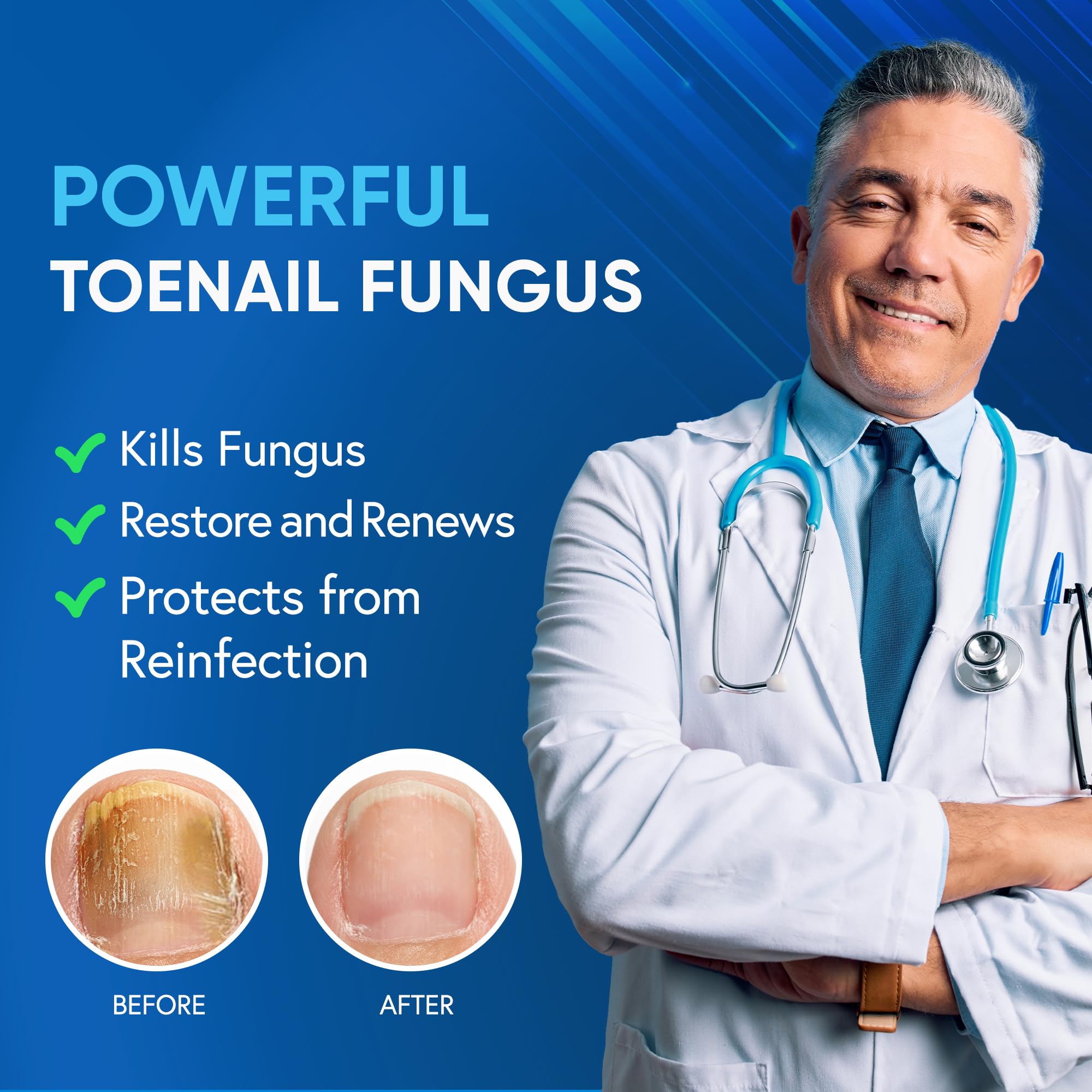 Tobcharm tea tree oil being applied to a toenail for antifungal care