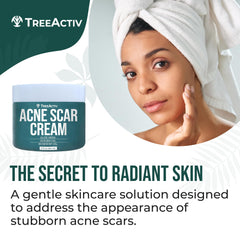 TreeActiv Acne Scar Cream Aloe Vera ingredient for soothing hydration.