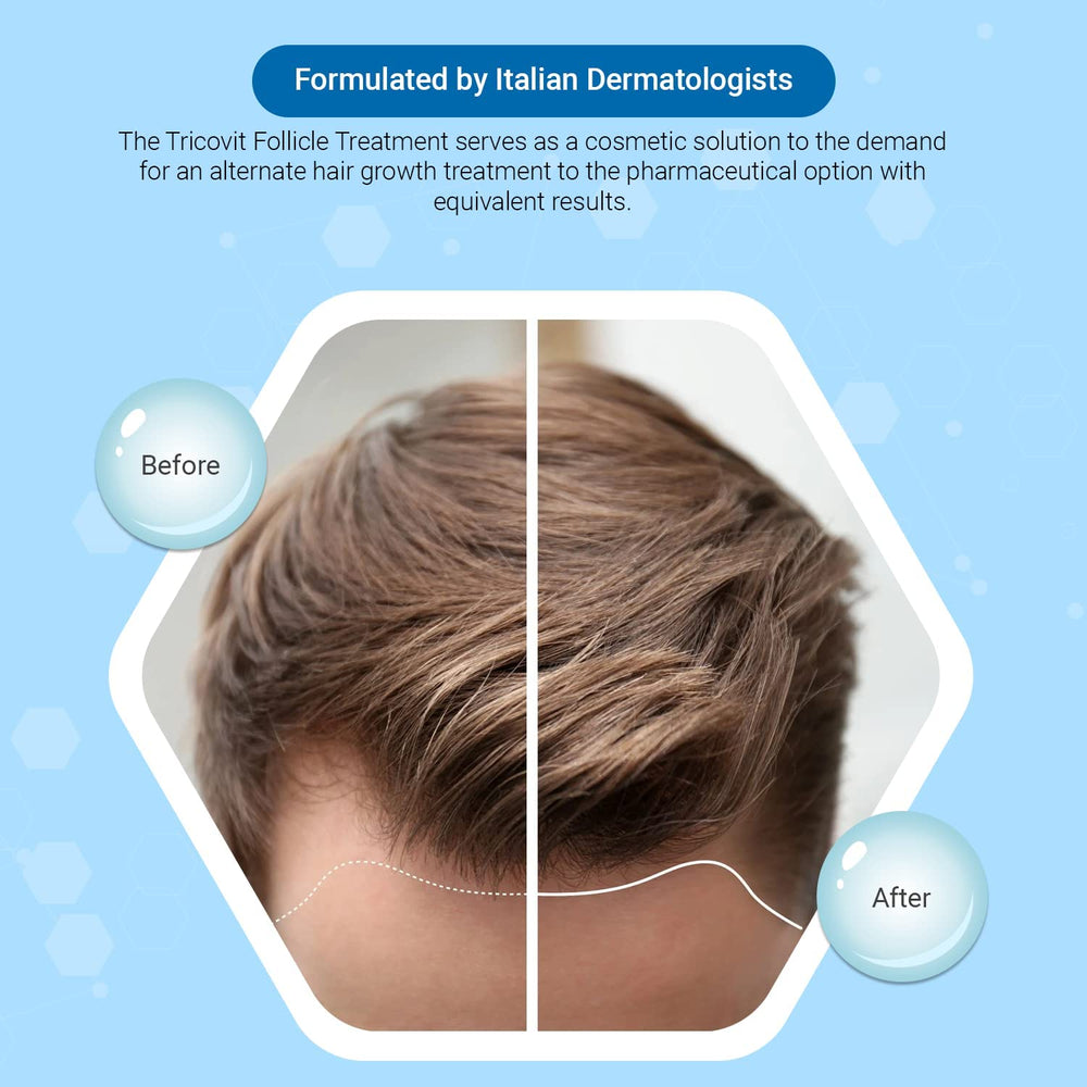 Tricovit capsules closeup highlighting amino acids and minerals for hair health.