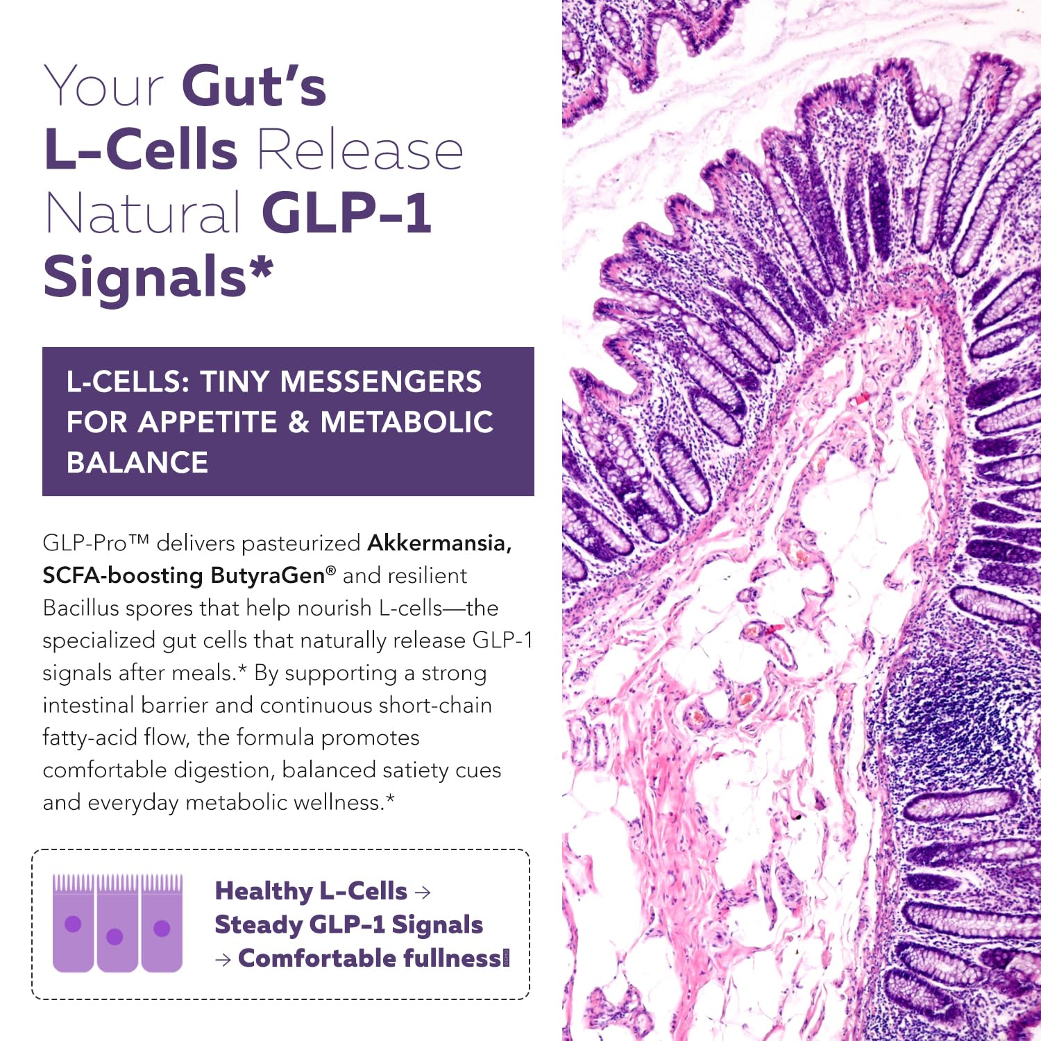 GLP-Pro label closeup highlights Akkermansia and ButyraGen ingredients.