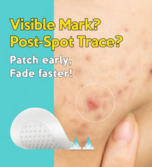 Troubless patch applied on clean skin shows seamless adhesion for comfortable wear