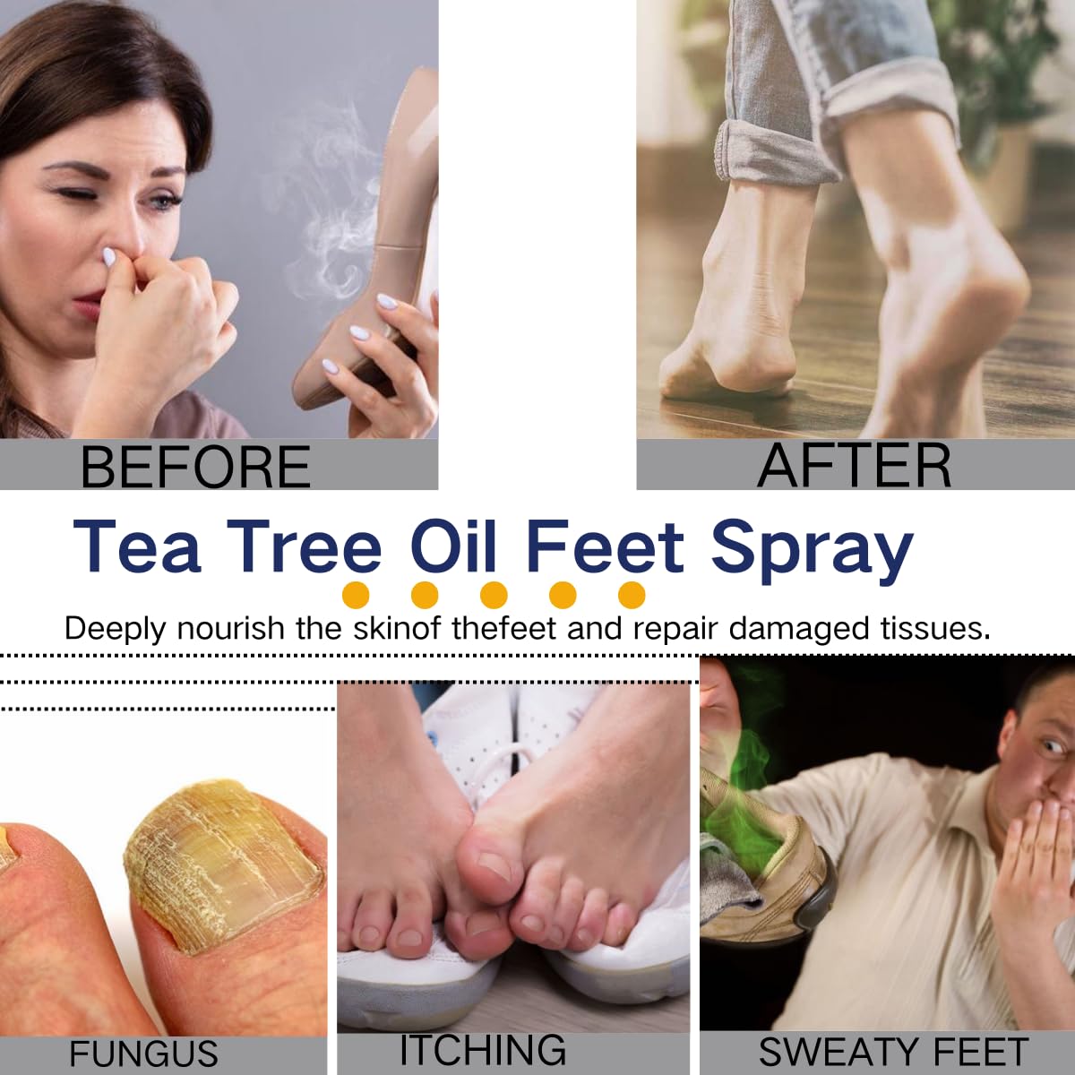 Uioecn Tea Tree Oil formula gentle on sensitive skin