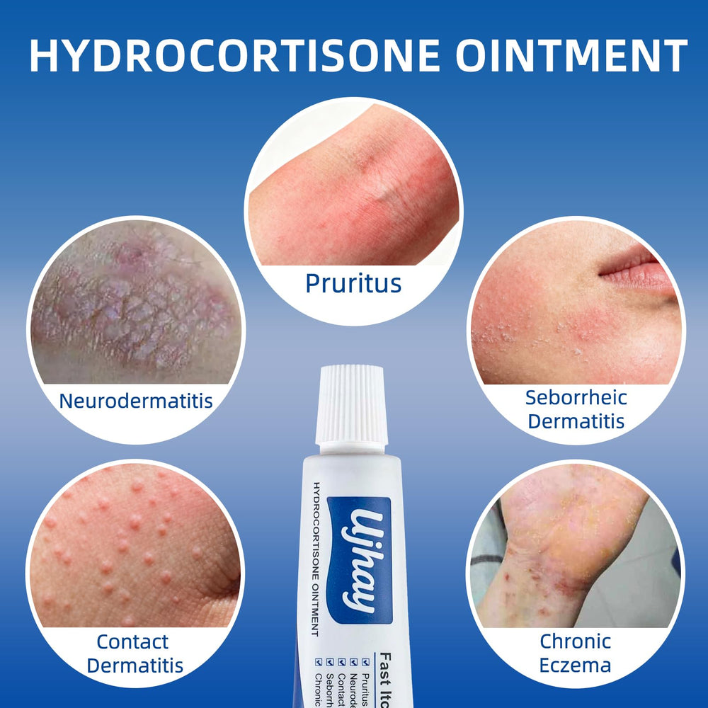 UJhay Hydrocortisone Ointment packaging shown for quick reference