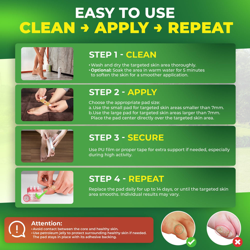 Ulensy Corn Remover Pads application steps illustrated for simple use.