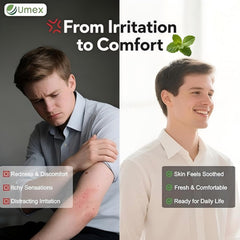 Close-up of quick-absorb texture of Umex Intensive Itch Relief Cream