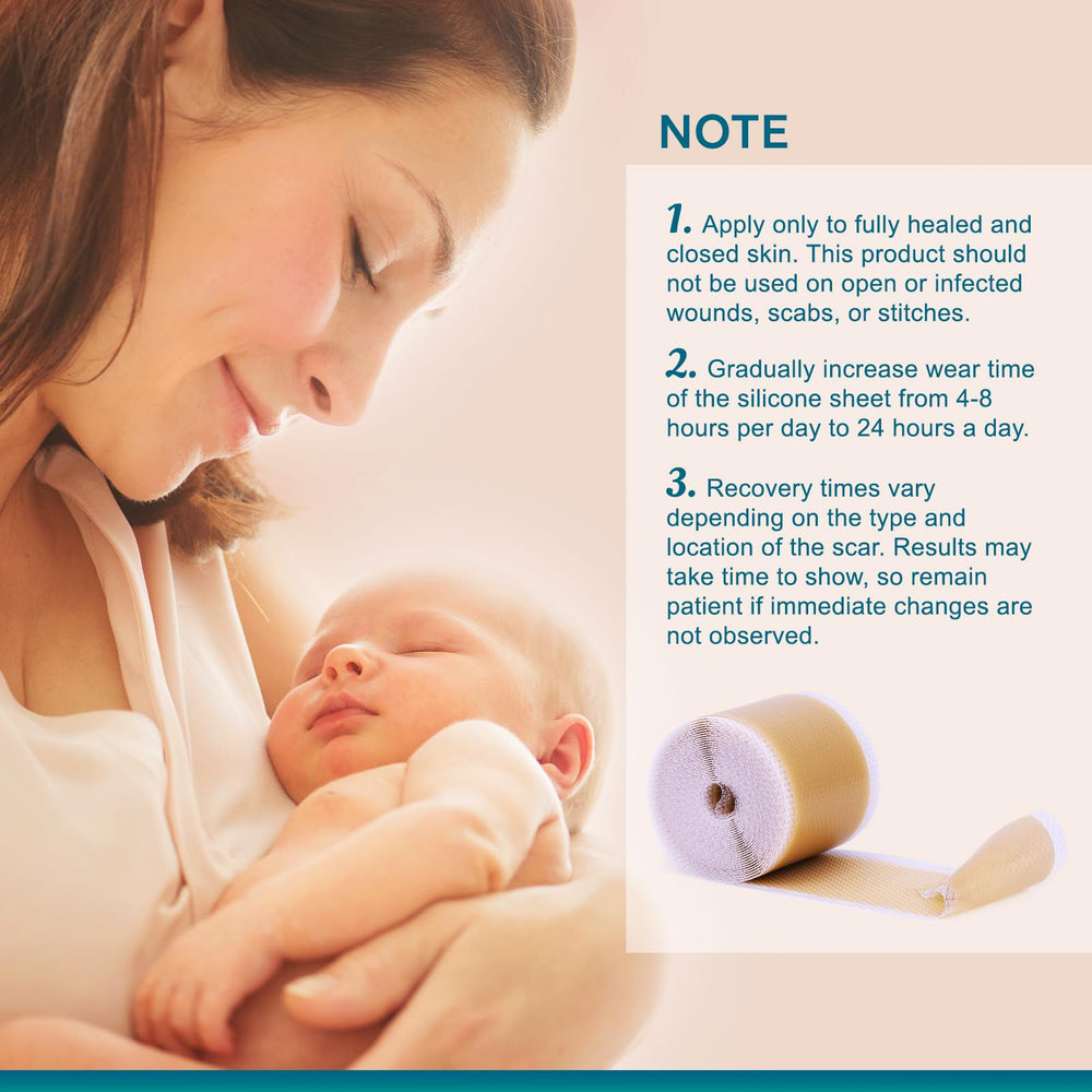 UNIEDI silicone scar sheets support post-surgery comfort during daily wear