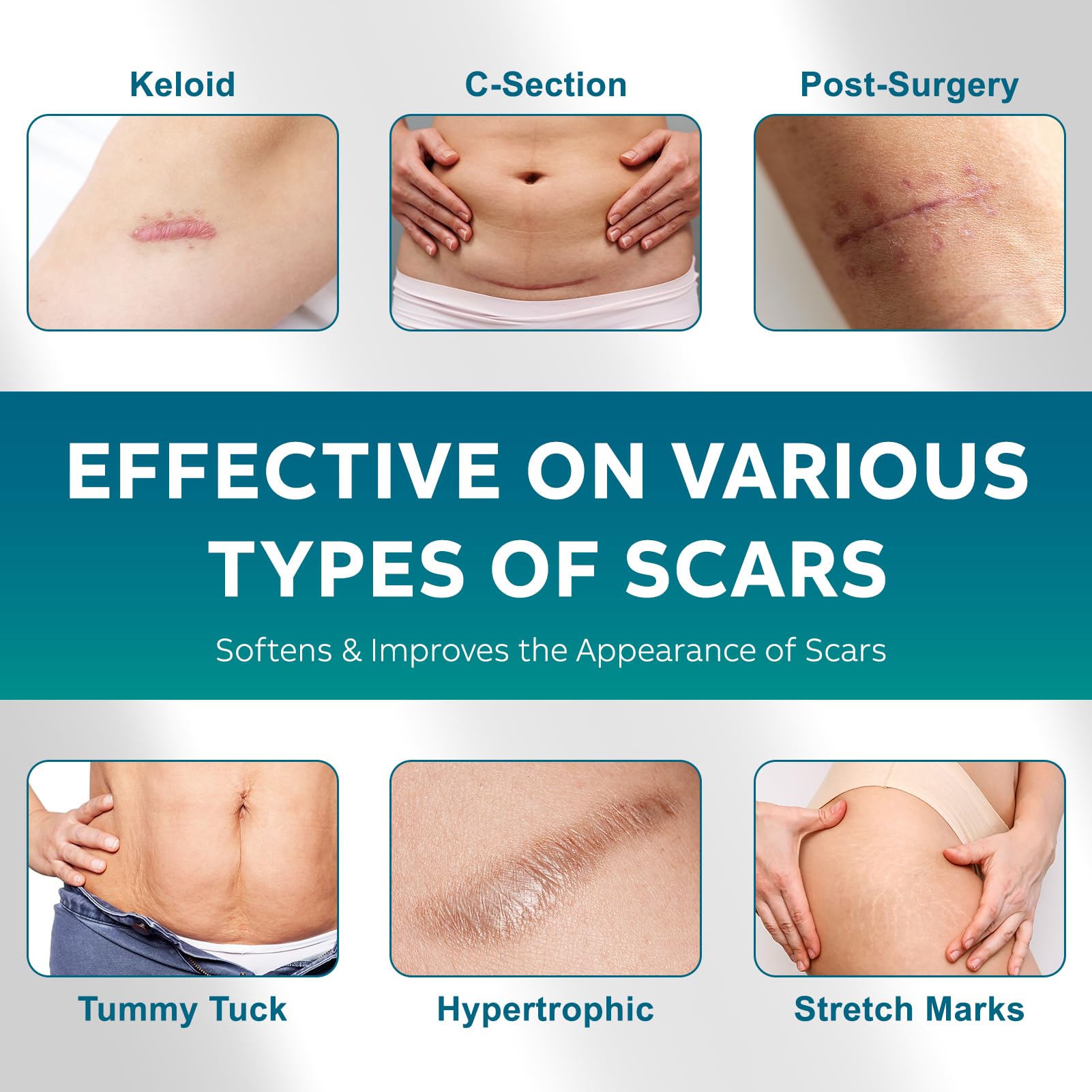 UNIEDI silicone scar strip closeup shows thin flexible protection