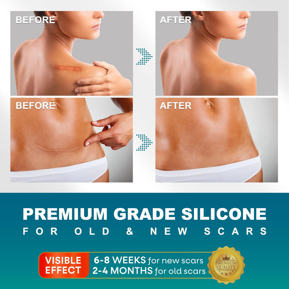 UNIEDI silicone scar tape on skin provides protective coverage