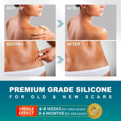 UNIEDI silicone scar tape on skin provides protective coverage