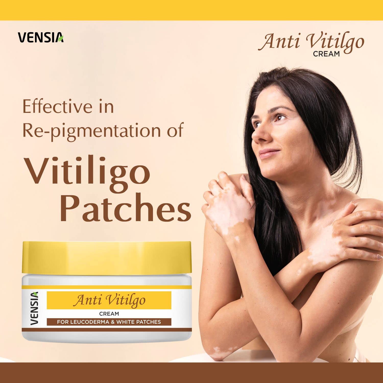 VENSIA Anti Vitiligo Cream applied on the face to even skin tone.