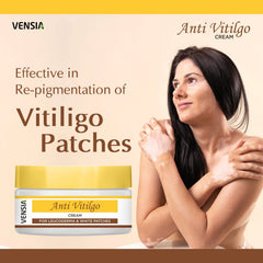 VENSIA Anti Vitiligo Cream applied on the face to even skin tone.