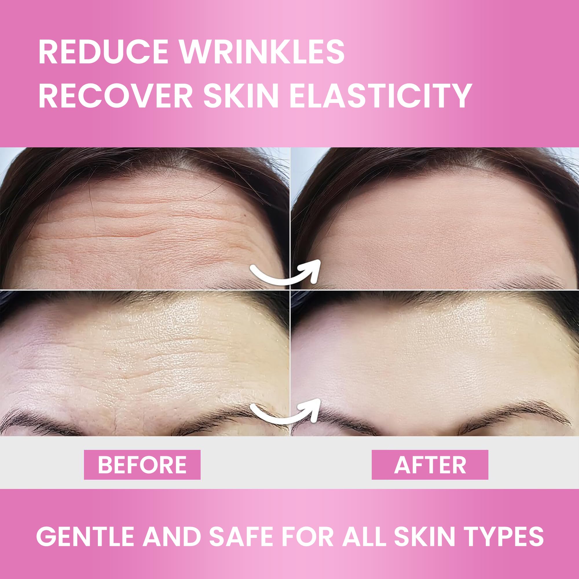 VIORY Forehead Patches pack front view signaling a reliable nightly skincare solution.