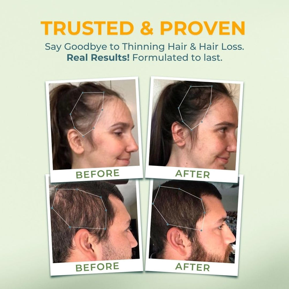 VITAL NUTRITIVE Vital Hair Complex ingredients close-up shows folate and vitamins.