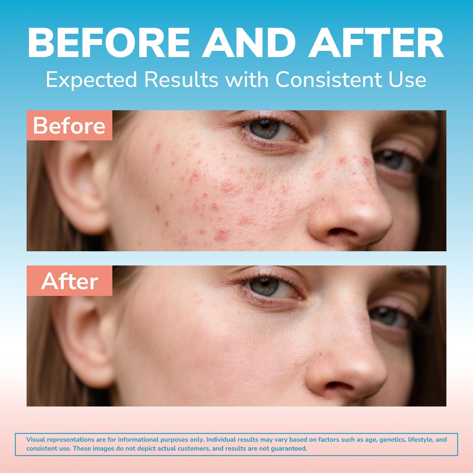 Vitalibre hyaluronic acid hydration component - helps maintain skin moisture and suppleness.