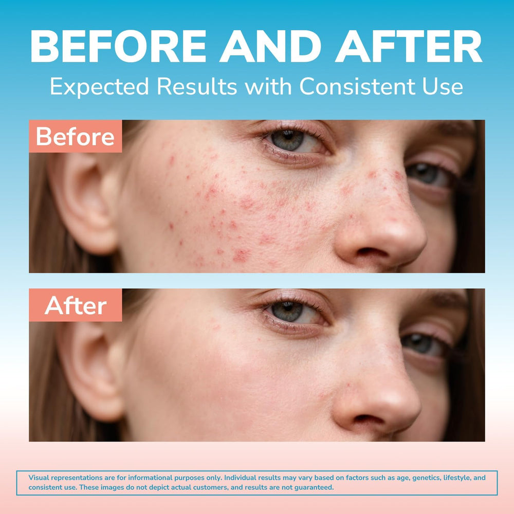 Vitalibre hyaluronic acid hydration component - helps maintain skin moisture and suppleness.