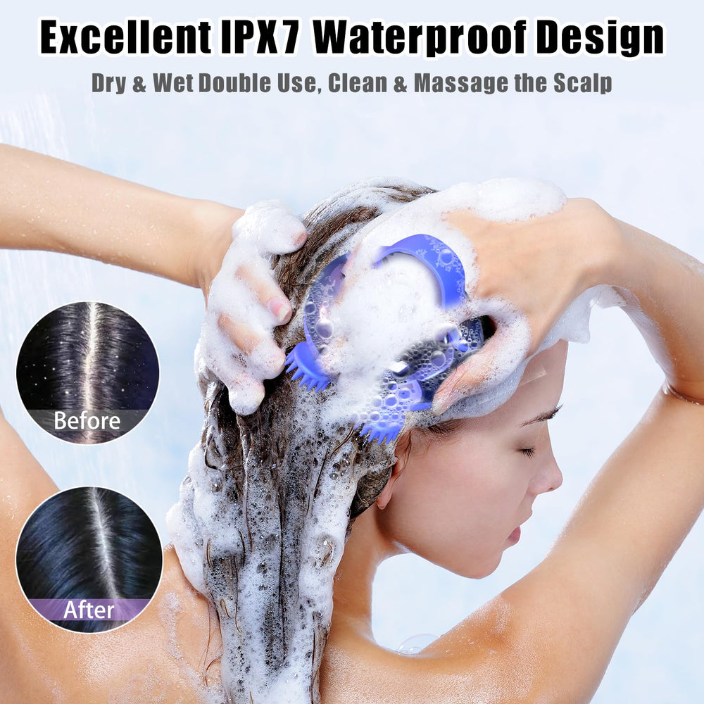 Viuyougor scalp massager silicone handle with anti-slip grip.