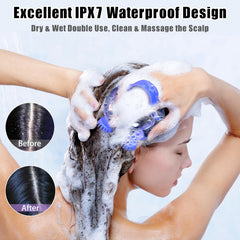 Viuyougor scalp massager silicone handle with anti-slip grip.