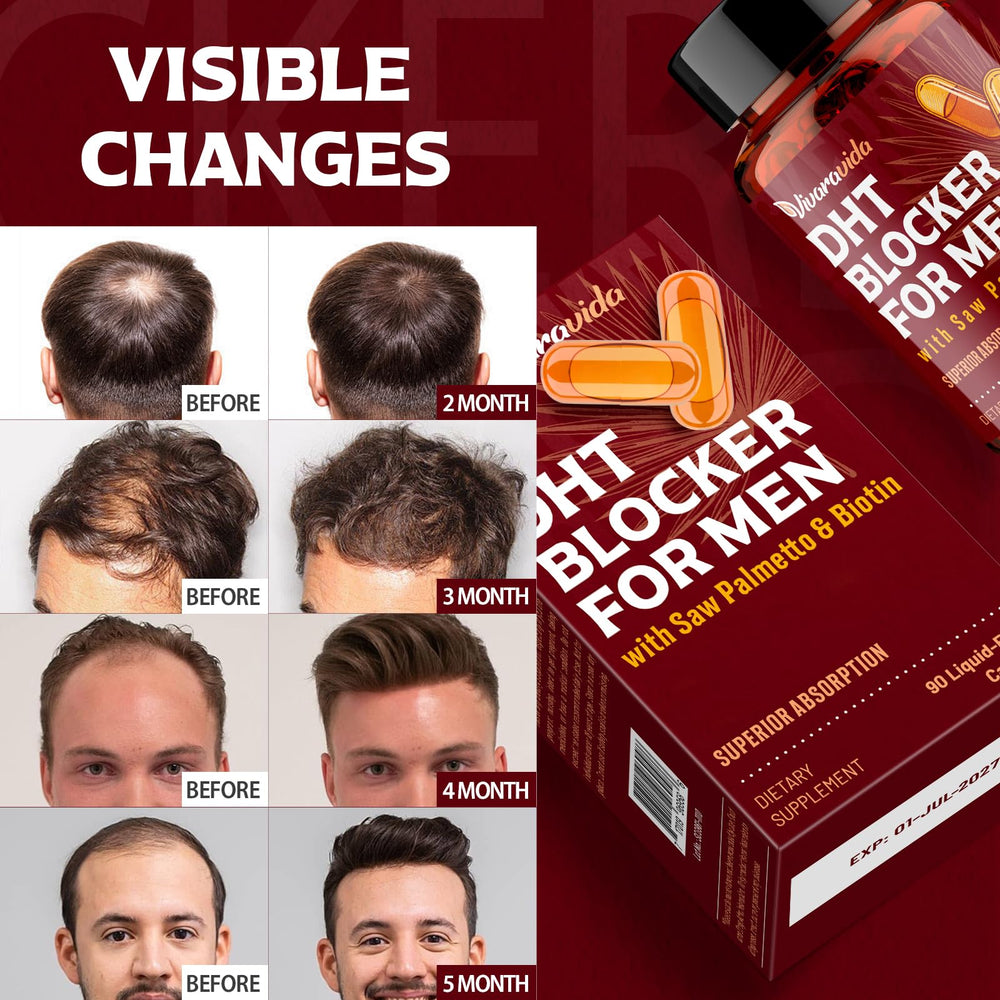 Vivaravida DHT Blocker liquid-filled capsule texture hints at rapid absorption