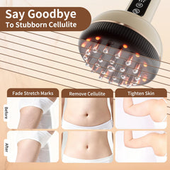 VLGOEM Lymphatic Drainage Massager leg-use photo emphasizes circulation support.