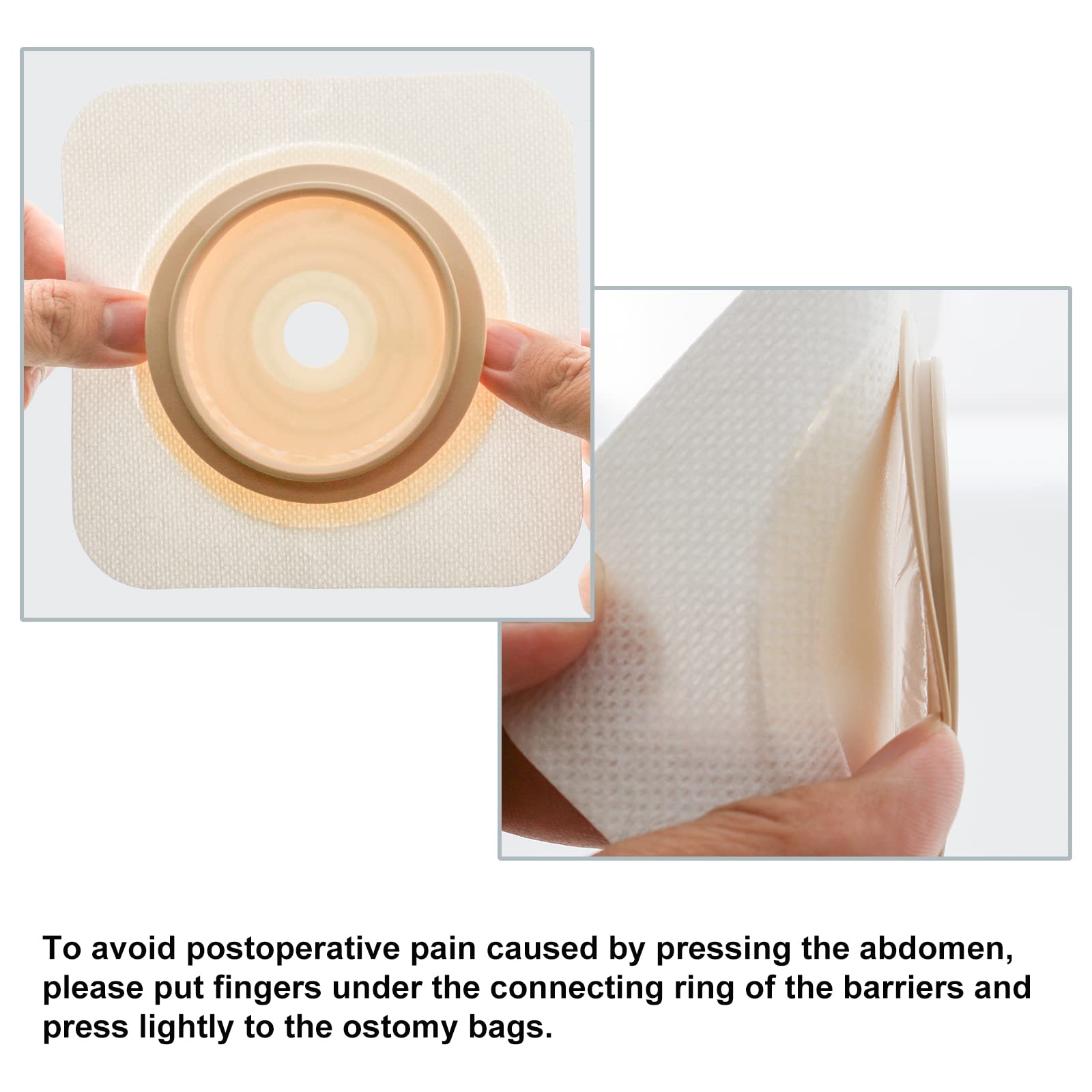 VLOOKUP cut to fit stoma hole range enables custom sizing