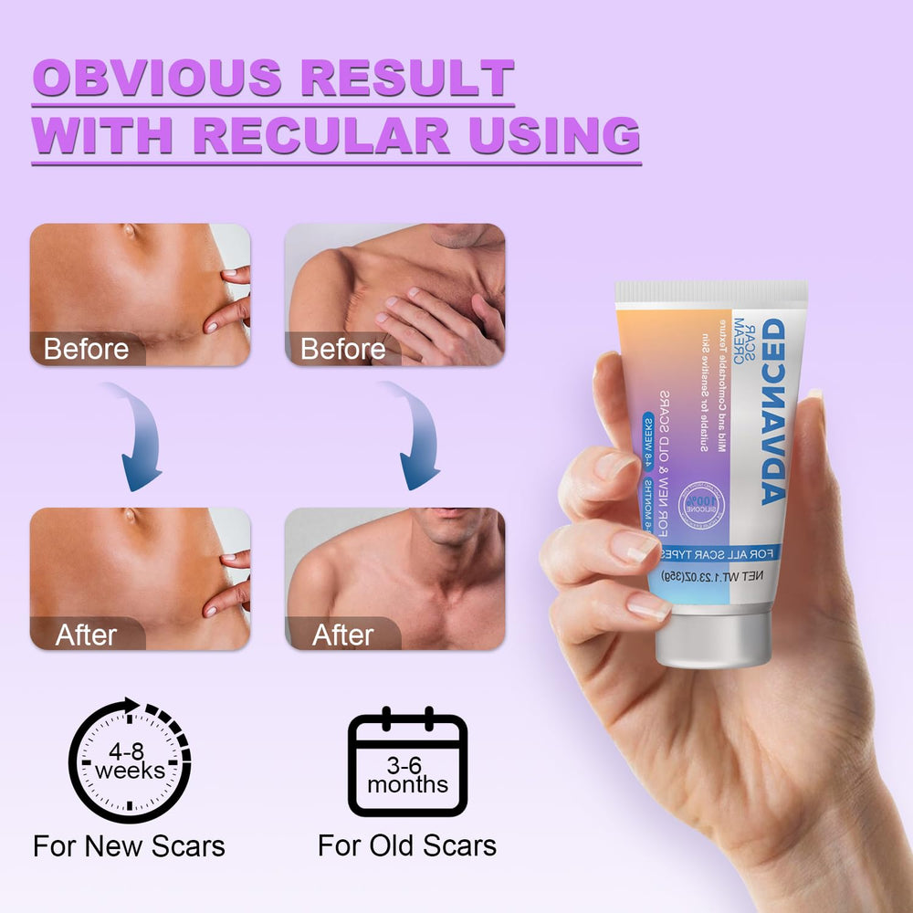 Voryn scar cream on hand shows gentle, comfortable daily routine.