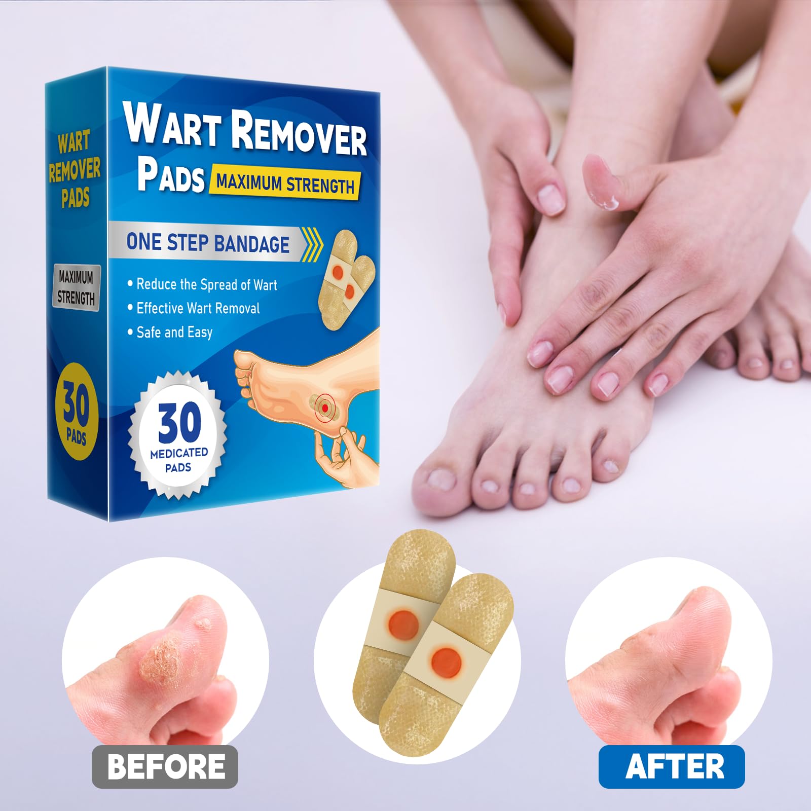 WABRINY Wart Remover Pad cushioned patch providing protection during wear.