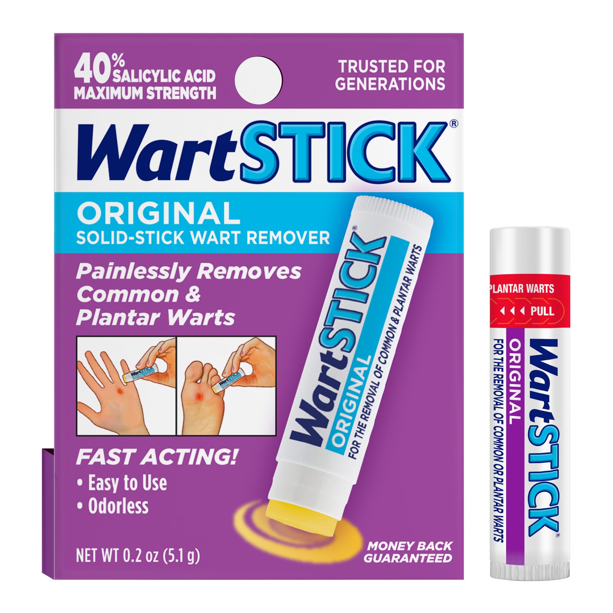 WartStick maximum-strength salicylic acid stick applied to plantar wart for fast, painless treatment.