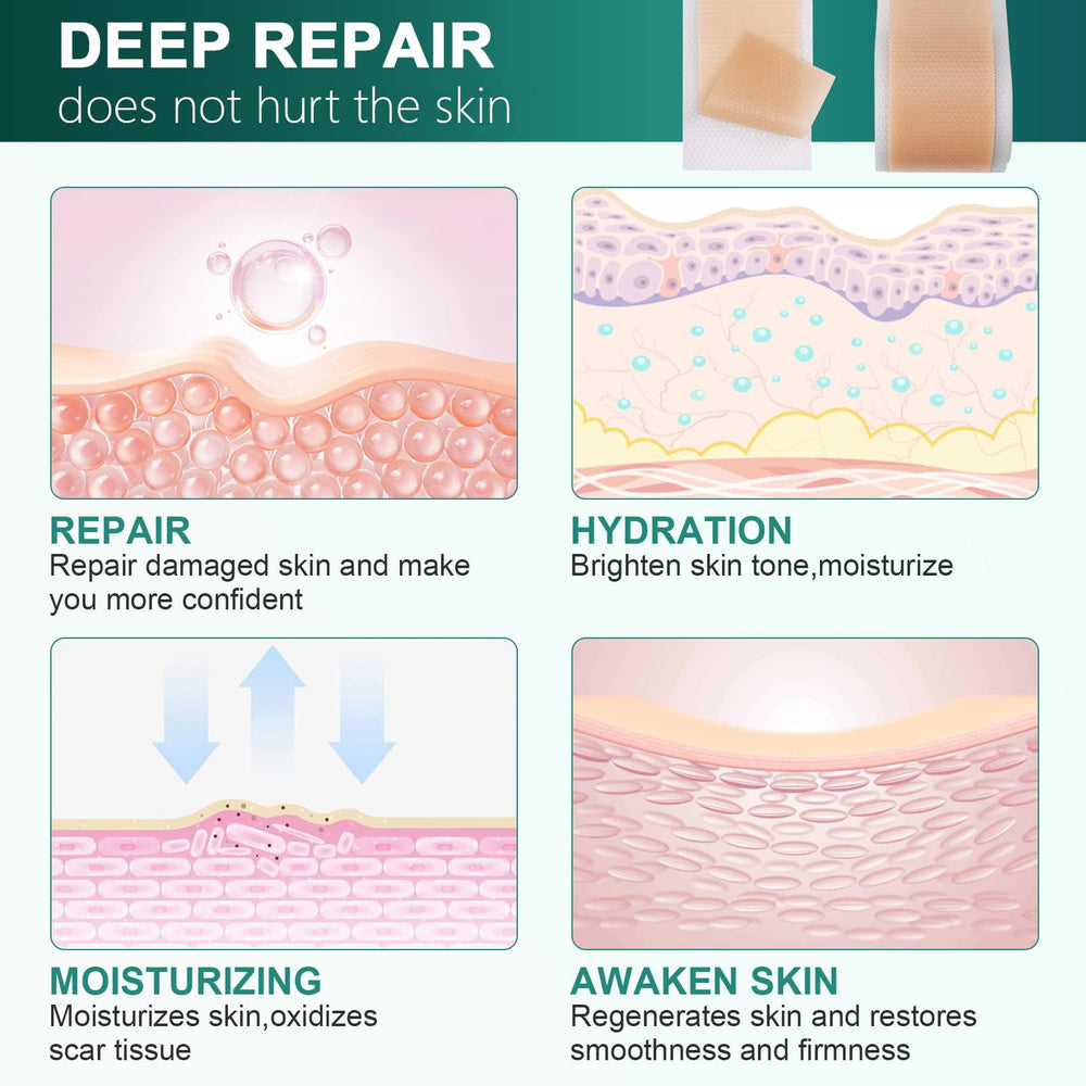 WeaShaemgLi silicone scar sheets shown under clothing for discreet protection