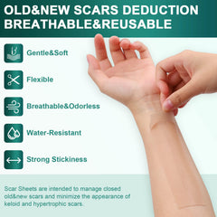 WeaShaemgLi silicone scar sheets on skin demonstrating comfortable wear under clothing