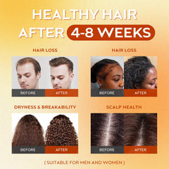 WEEMOTD Batana Oil massage for scalp nourishment and relaxation.