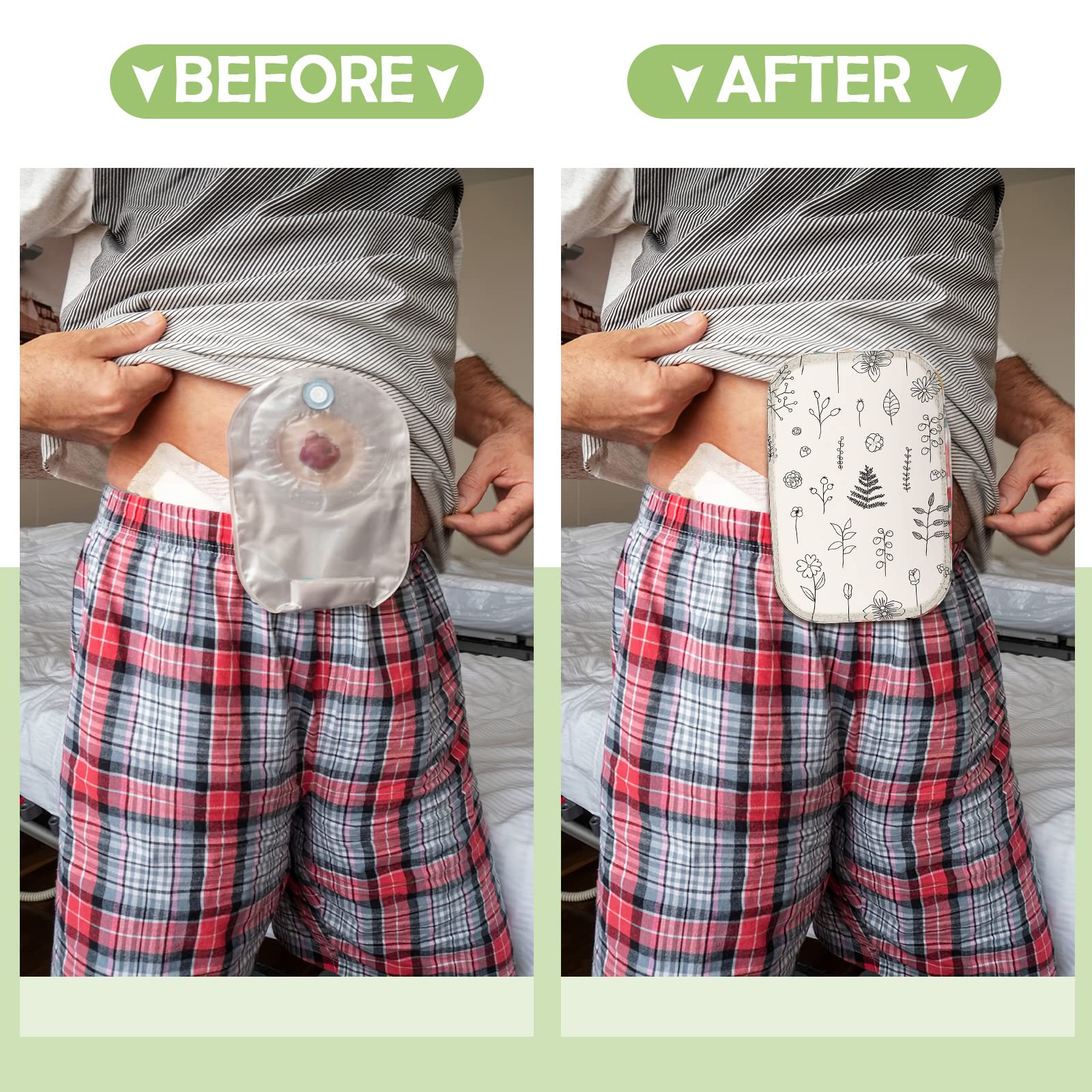 Weewooday washable ostomy cover helps reduce stains and odors