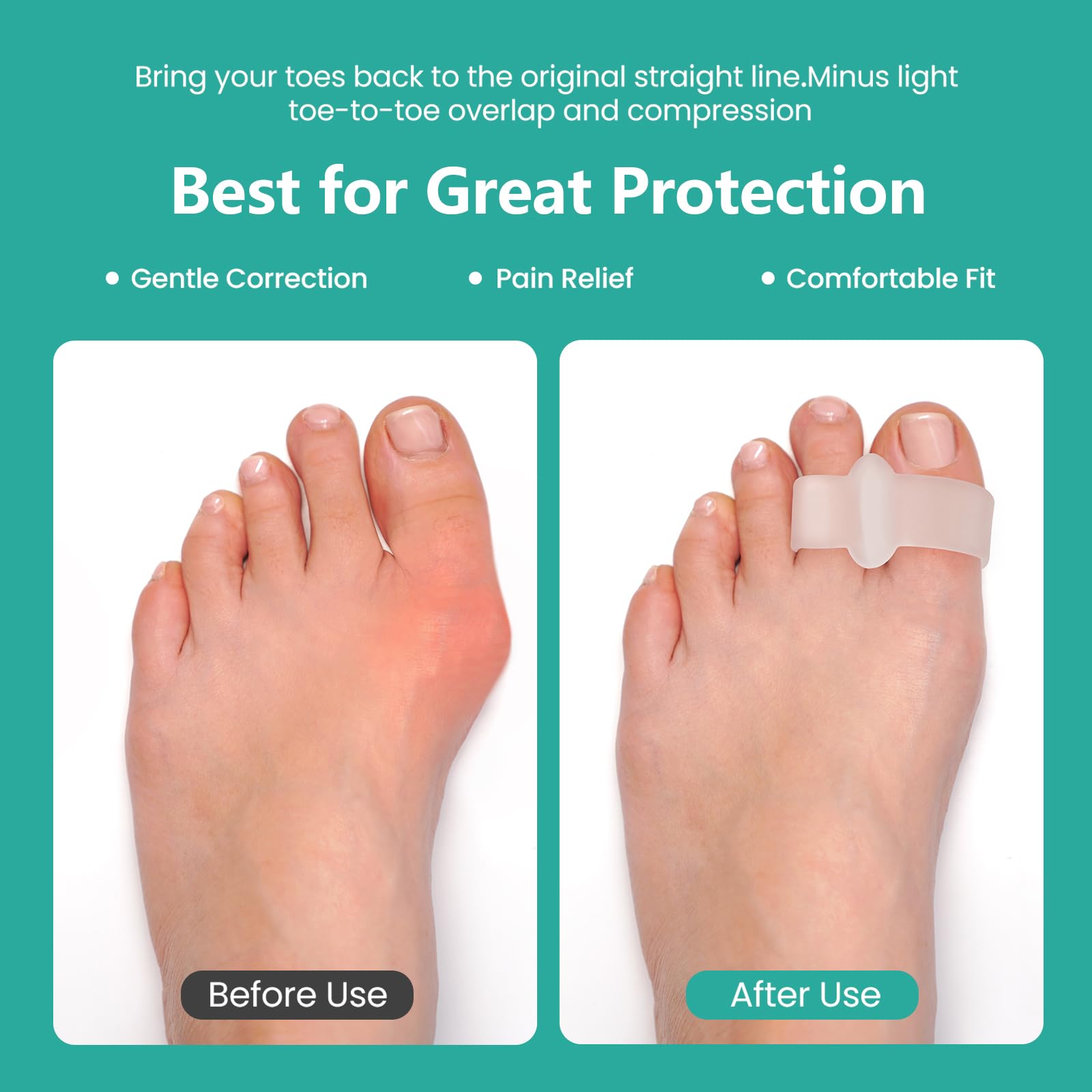 Welnove bunion pads fit most shoes for daily comfort.