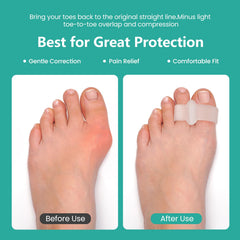 Welnove bunion pads fit most shoes for daily comfort.
