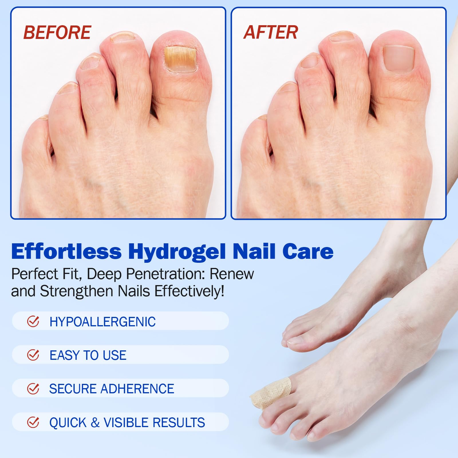 WLCTJIAYOU patch helps address discoloration over time on nails.
