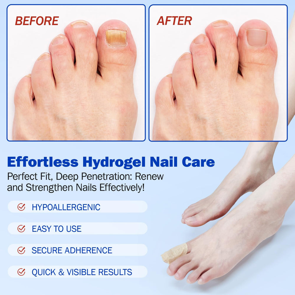 WLCTJIAYOU patch helps address discoloration over time on nails.