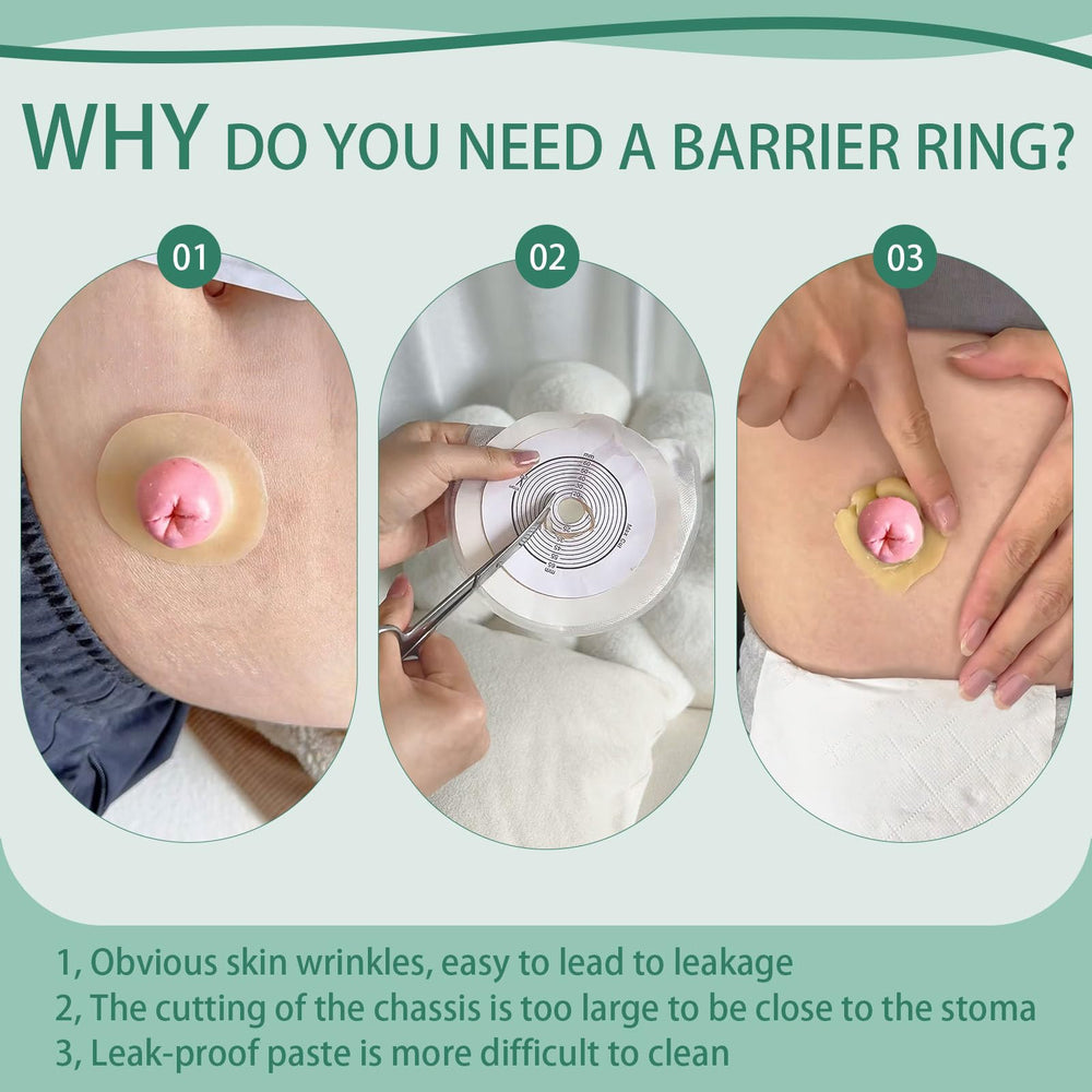 XIIFIIFII elastic moldable ring fits skin for comfortable wear