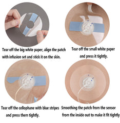 XILETIGOHA waterproof infusion patch supports extended wear during showers and workouts.