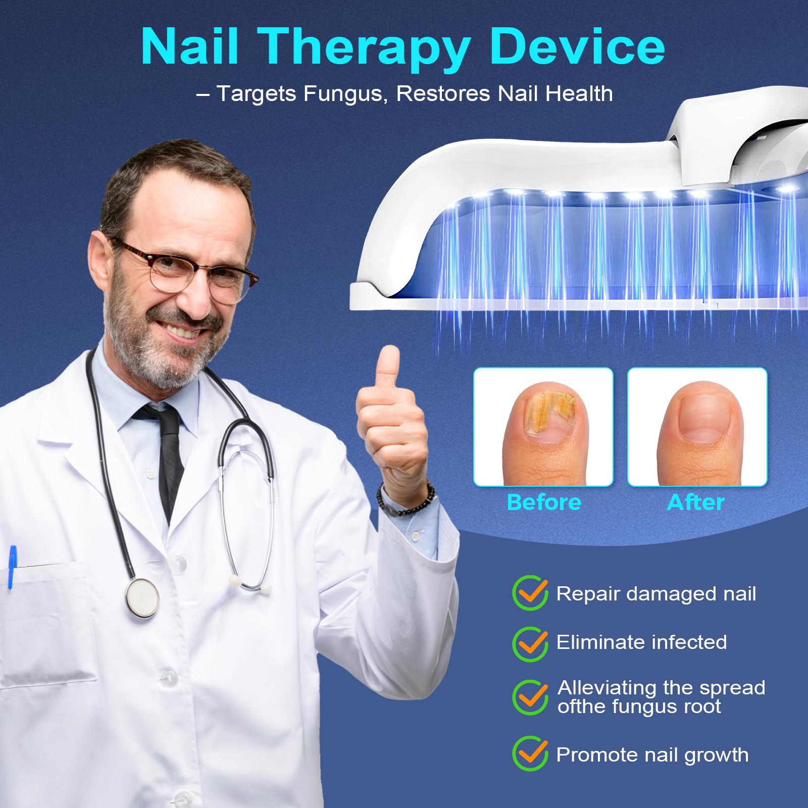 XiNanc nail health progress with the device after weeks of treatment.